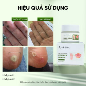 Kem chấm Mụn Cóc, Mụn Cơm Tinh Chất Đu Đủ